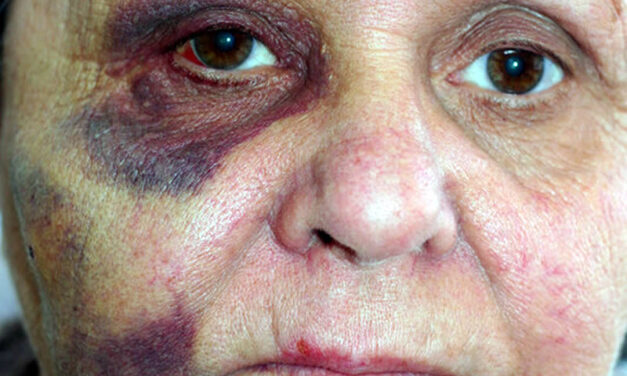Elder Abuse – how widespread is it and what can be done to prevent it?