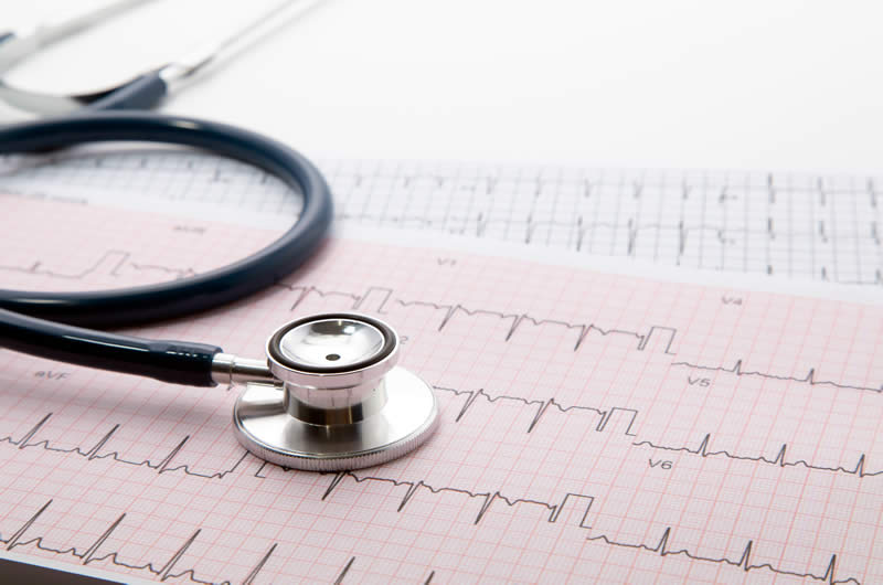 ECG recording with stethoscope